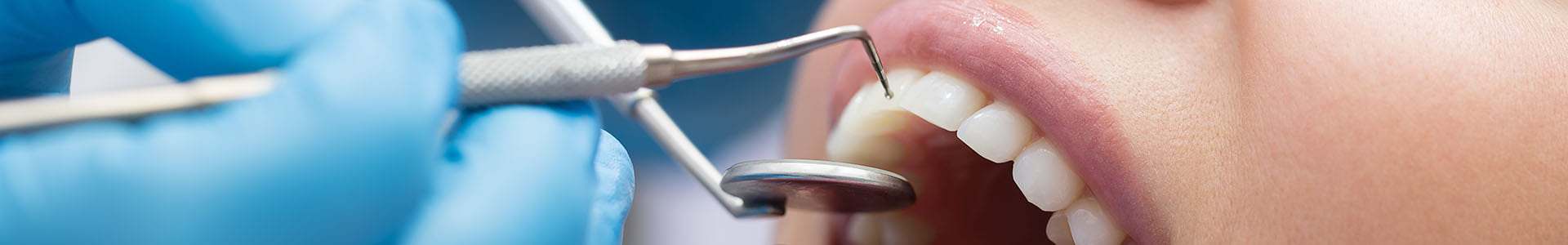 Ortodoncia Invisible en Benalmádena