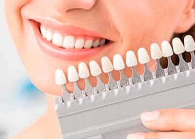 Tratamientos para mejorar la estética de tu dentadura