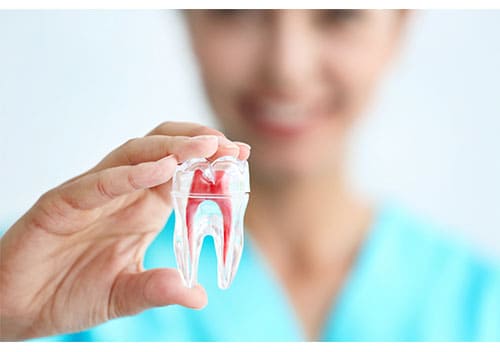 Tratamientos de endodoncia en Benalmádena