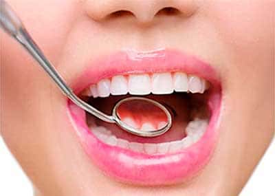 Estética Dental en Benalmádena