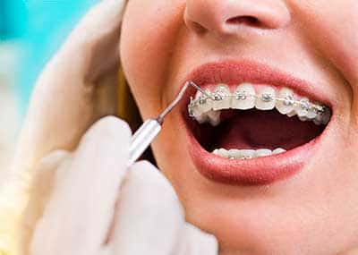 Clínica de Ortodoncia en Benalmádena