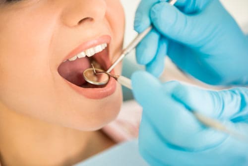 Periodoncista en Benalmádena
