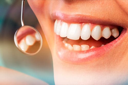Clínica de periodoncia en Benalmádena