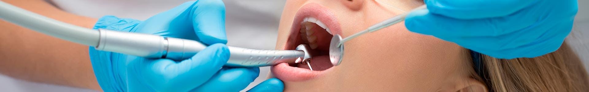 Endodoncista en Benalmádena