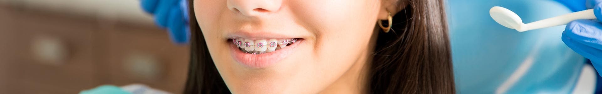 Tratamientos de Ortodoncia en Benalmádena